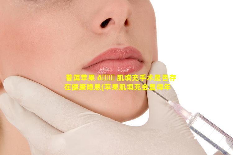 普洱苹果 🐝 肌填充手术是否存在健康隐患(苹果肌填充会显得年轻吗)